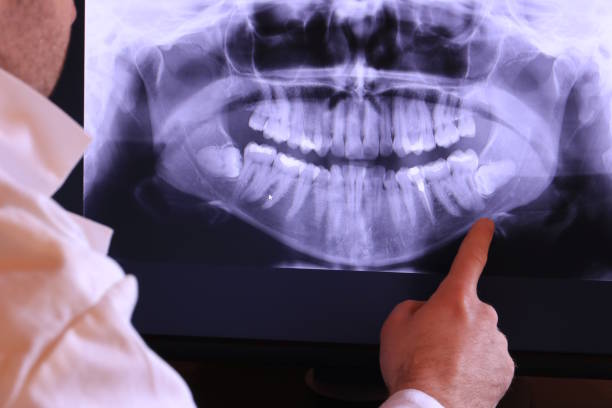 Best Emergency Dentist for Lost Fillings or Crowns in Lompoc, CA